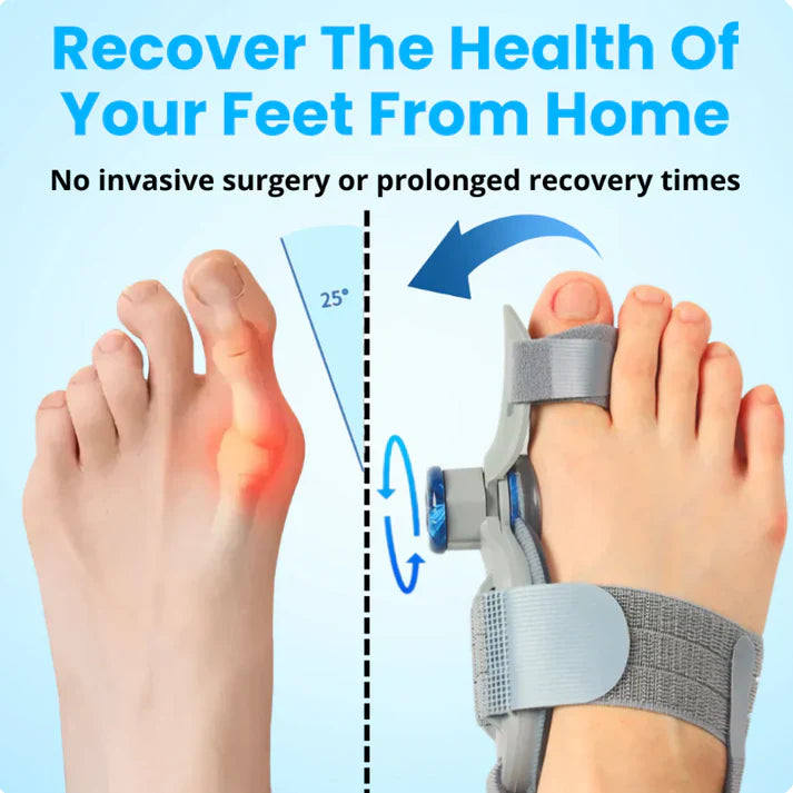 Unisex Bunion Corrector